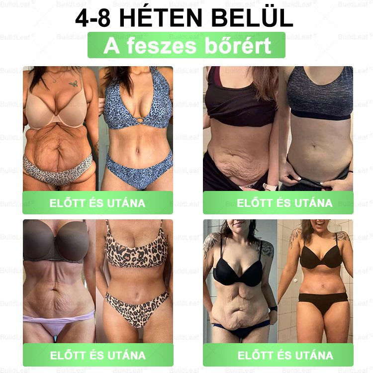 ✨𝐁𝐮𝐢𝐥𝐝𝐋𝐞𝐚𝐟® 𝐆𝐋𝐏-𝟏 𝟖-𝐢𝐧-𝟏 𝐒𝐥𝐢𝐦 & 𝐇𝐞𝐚𝐥𝐭𝐡𝐲 𝐎𝐫á𝐥𝐢𝐬 𝐌𝐞𝐠𝐨𝐥𝐝á𝐬 ✅ 𝐓á𝐦𝐨𝐠𝐚𝐭𝐣𝐚 𝐚𝐳 𝐞𝐥𝐡í𝐳á𝐬 𝐤𝐞𝐳𝐞𝐥é𝐬é𝐭, 𝐚 𝐬𝐳í𝐯- é𝐬 é𝐫𝐫𝐞𝐧𝐝𝐬𝐳𝐞𝐫𝐢 𝐞𝐠é𝐬𝐳𝐬é𝐠𝐞𝐭, 𝐚 𝐜𝐮𝐤𝐨𝐫𝐛𝐞𝐭𝐞𝐠𝐬é𝐠𝐞𝐭, 𝐚𝐳 𝐚𝐥𝐯á𝐬𝐢 𝐚𝐩𝐧𝐨é𝐭, 𝐚 𝐛é𝐥𝐫𝐞𝐧𝐝𝐬𝐳𝐞𝐫 𝐞𝐠é𝐬𝐳𝐬é𝐠é𝐭, 𝐦𝐢𝐤ö𝐳𝐛𝐞𝐧 𝐟𝐞𝐬𝐳𝐞𝐬í𝐭𝐢 𝐚 𝐛ő𝐫𝐭 é𝐬 𝐧ö𝐯𝐞𝐥𝐢 𝐚𝐳 𝐞𝐧𝐞𝐫𝐠𝐢á𝐭.