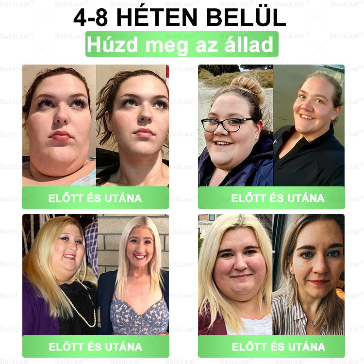 ✨𝐁𝐮𝐢𝐥𝐝𝐋𝐞𝐚𝐟® 𝐆𝐋𝐏-𝟏 𝟖-𝐢𝐧-𝟏 𝐒𝐥𝐢𝐦 & 𝐇𝐞𝐚𝐥𝐭𝐡𝐲 𝐎𝐫á𝐥𝐢𝐬 𝐌𝐞𝐠𝐨𝐥𝐝á𝐬 ✅ 𝐓á𝐦𝐨𝐠𝐚𝐭𝐣𝐚 𝐚𝐳 𝐞𝐥𝐡í𝐳á𝐬 𝐤𝐞𝐳𝐞𝐥é𝐬é𝐭, 𝐚 𝐬𝐳í𝐯- é𝐬 é𝐫𝐫𝐞𝐧𝐝𝐬𝐳𝐞𝐫𝐢 𝐞𝐠é𝐬𝐳𝐬é𝐠𝐞𝐭, 𝐚 𝐜𝐮𝐤𝐨𝐫𝐛𝐞𝐭𝐞𝐠𝐬é𝐠𝐞𝐭, 𝐚𝐳 𝐚𝐥𝐯á𝐬𝐢 𝐚𝐩𝐧𝐨é𝐭, 𝐚 𝐛é𝐥𝐫𝐞𝐧𝐝𝐬𝐳𝐞𝐫 𝐞𝐠é𝐬𝐳𝐬é𝐠é𝐭, 𝐦𝐢𝐤ö𝐳𝐛𝐞𝐧 𝐟𝐞𝐬𝐳𝐞𝐬í𝐭𝐢 𝐚 𝐛ő𝐫𝐭 é𝐬 𝐧ö𝐯𝐞𝐥𝐢 𝐚𝐳 𝐞𝐧𝐞𝐫𝐠𝐢á𝐭.